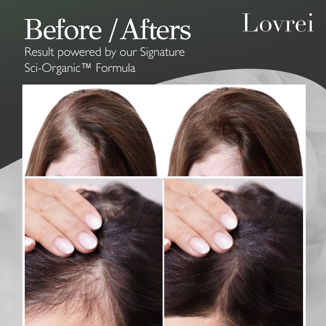 Hair Growth Bundle with Sci-Organic™ Formulation